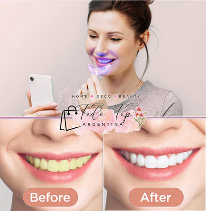 Blanqueador Dental USB – Sonríe con Confianza y Brillo Profesional